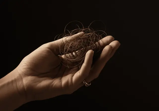 Queda de cabelo